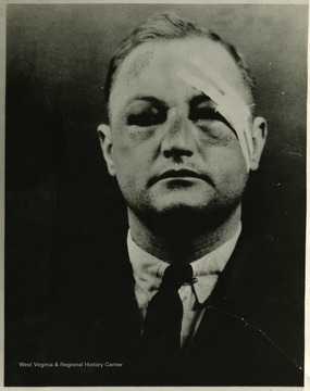 Portrait of Maston White, 'victim of the 'Czar', Don Chafin.'